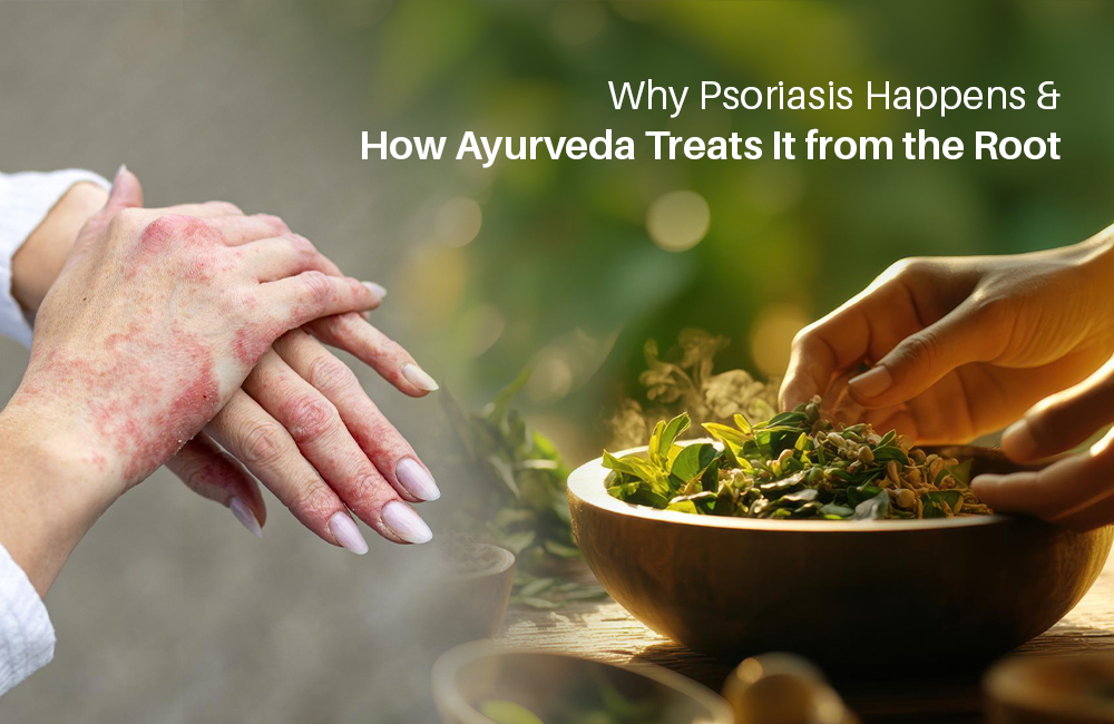 Why Psoriasis Happens and How Ayurveda Treats It from the Root.