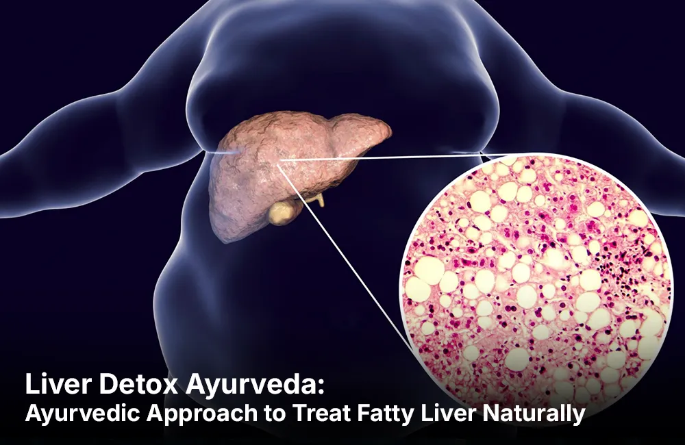 Liver Detox Ayurveda: Ayurvedic Approach to Treat Fatty Liver Naturally
